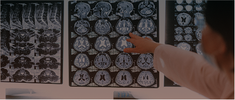 AI-powered healthcare solution analyzing brain MRI scans for accurate medical diagnosis and clinical decision support.